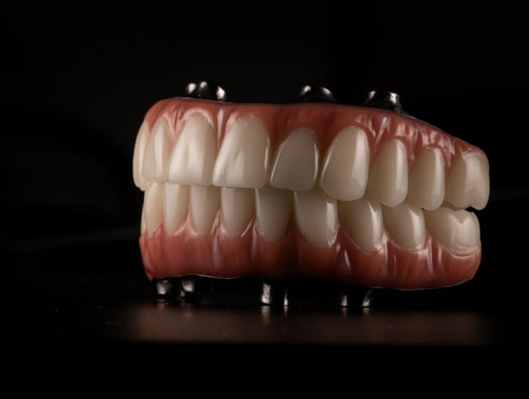 A Comprehensive Solution for Your Smile